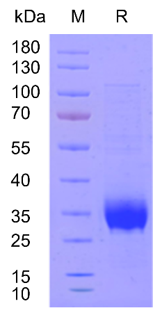 W88优德官网新品速递 | 重组人TPO蛋白震撼上市！精准调控造血，解锁干细胞培养新维度